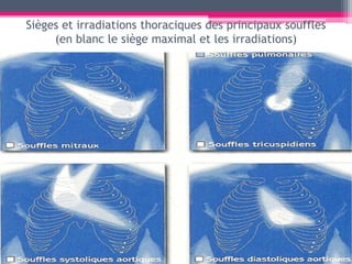image.slidesharecdn.com/auscultationcardiaque-1212...