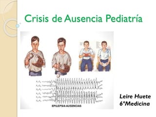 Crisis de Ausencia Pediatría
Leire Huete
6ºMedicina
 