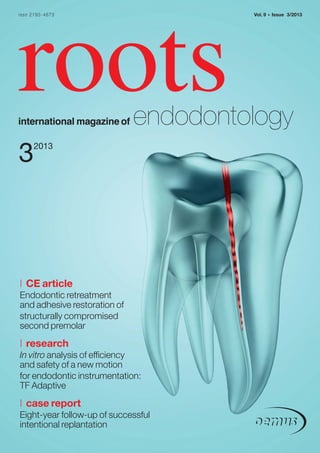 issn 2193-4673

roots

international magazine of

Vol. 9

•

Issue 3/2013

endodontology

3

2013

| CE article
Endodontic retreatment
and adhesive restoration of
structurally compromised
second premolar

| research

In vitro analysis of efficiency
and safety of a new motion
for endodontic instrumentation:
TF Adaptive

| case report
Eight-year follow-up of successful
intentional replantation

 