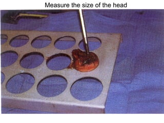 Measure the size of the head 