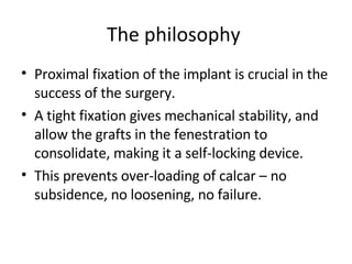 The philosophy  Proximal fixation of the implant is crucial in the success of the surgery. A tight fixation gives mechanical stability, and allow the grafts in the fenestration to consolidate, making it a self-locking device. This prevents over-loading of calcar – no subsidence, no loosening, no failure. 
