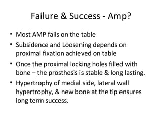 Failure & Success - Amp? Most AMP fails on the table  Subsidence and Loosening depends on proximal fixation achieved on table Once the proximal locking holes filled with bone – the prosthesis is stable & long lasting. Hypertrophy of medial side, lateral wall hypertrophy, & new bone at the tip ensures long term success.  