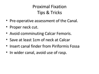 Proximal Fixation Tips & Tricks Pre-operative assessment of the Canal. Proper neck cut. Avoid comminuting Calcar Femoris. Save at least 1cm of neck at Calcar Insert canal finder from Piriformis Fossa In wider canal, avoid use of rasp. 