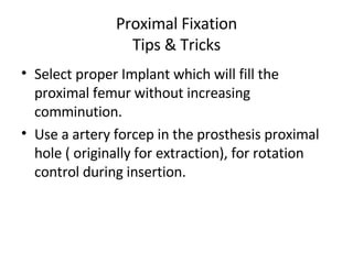 Proximal Fixation Tips & Tricks Select proper Implant which will fill the proximal femur without increasing comminution.  Use a artery forcep in the prosthesis proximal hole ( originally for extraction), for rotation control during insertion. 