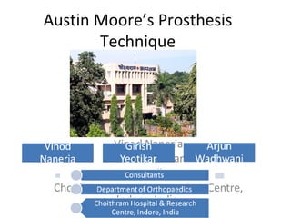 Austin Moore’s Prosthesis Technique Vinod Naneria Girish Yeotikar Arjun Wadhwani Choithram Hospital & Research Centre, Indore, India  