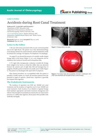 Citation: Pedruzzi B, Carlo RD and Girasoli L. Accidents during Root Canal Treatment. Austin J Otolaryngol.
2018; 5(1): 1099.
Austin J Otolaryngol - Volume 5 Issue 1 - 2018
ISSN : 2473-0645 | www.austinpublishinggroup.com
Pedruzzi et al. © All rights are reserved
Austin Journal of Otolaryngology
Open Access
Letter to Editor
Accidents during Root Canal Treatment
Pedruzzi B1
*, Carlo RD2
and Girasoli L2
1
Department of ENT, Monselice, Italy
2
Department of Neurosciences, Institute of
Otorhinolaryngology, Padova University, Italy
*Corresponding author: Barbara Pedruzzi, ENT
Department, Ospedali Riuniti Padova Sud, “Madre Teresa
di Calcutta”, Italy
Received: April 20, 2018; Accepted: May 02, 2018;
Published: May 09, 2018
Letter to the Editor
A 46-year-old woman presented with an acute restricted painful
area in her right throat. The patient was in the odontostomatology
room during a dental root canal treatment, and she inhaled the needle
for dental root curettage. No dyspnea. No dysphonia. No dysphagia.
An urgent X-ray showed the presence of a metallic needle-shaped
foreign body in the larynx (Figure 1), in a very dangerous site for
inhalation into trachea or bronchi and its hazardous risks.
A 70°
rigid video laryngoscopic evaluation revealed the foreign
body wedged in her larynx, in detail the rubber dam was skewered
between the anterior part of right false fold and laryngeal face of
epiglottis. Metallic portion of dental root needle wasn’t visible (Figure
2). The patient was discharged with rapid relief of symptoms.
Most dental procedures are accomplished while the patient is
partially or totally supine; as a result, all restorative patients have the
potential to ingest or aspirate a dental item. Aspiration is generally
less frequent than ingestion.
The Endodontic Instruments
The incidence of aspiration was 0.001 per 100,000 root canal
treatments and the incidence of ingestion was 0.12 per 100,000 root
canal treatments. Early location of an inhaled or ingested foreign
body facilitates appropriate and timely treatment management and
referral. The principle of nonmaleficence dictates the use of preventive
practices (i.e. rubber dam, ligatures, throat pack) when possible, both
medically and legally.
Figure 1: Enlarge detail on the right.
Figure 2: The foreign body was successfully removed in endoscopic view
under local anesthesia with laryngeal forceps (Jurasz forceps).
 