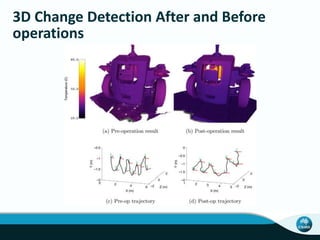 3D Change Detection After and Before
operations
 
