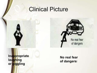 Clinical Picture
No real fear
of dangers!
Inappropriate
laughing
or giggling
 