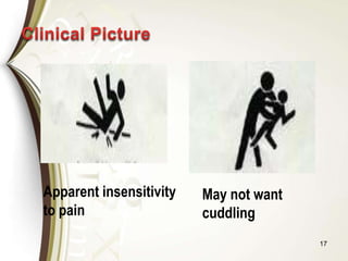17
Apparent insensitivity
to pain
May not want
cuddling
 