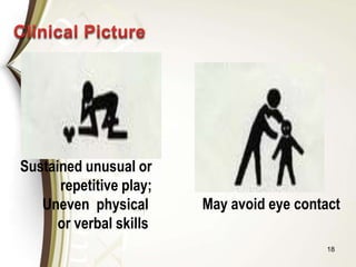 18
Sustained unusual or
repetitive play;
Uneven physical
or verbal skills
May avoid eye contact
 