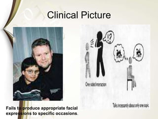 Clinical Picture
Fails to produce appropriate facial
expressions to specific occasions.
 