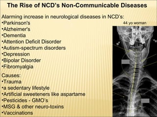 The Rise of NCD’s Non-Communicable Diseases
Alarming increase in neurological diseases in NCD’s:
•Parkinson's
•Alzheimer's
•Dementia
•Attention Deficit Disorder
•Autism-spectrum disorders
•Depression
•Bipolar Disorder
•Fibromyalgia
Causes:
•Trauma
•a sedentary lifestyle
•Artificial sweeteners like aspartame
•Pesticides - GMO’s
•MSG & other neuro-toxins
•Vaccinations
44 yo woman
 