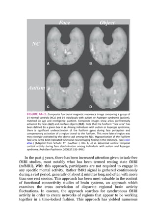 Autism introduction clinical feature dia | PDF
