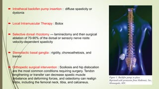 Autism and dev disorders