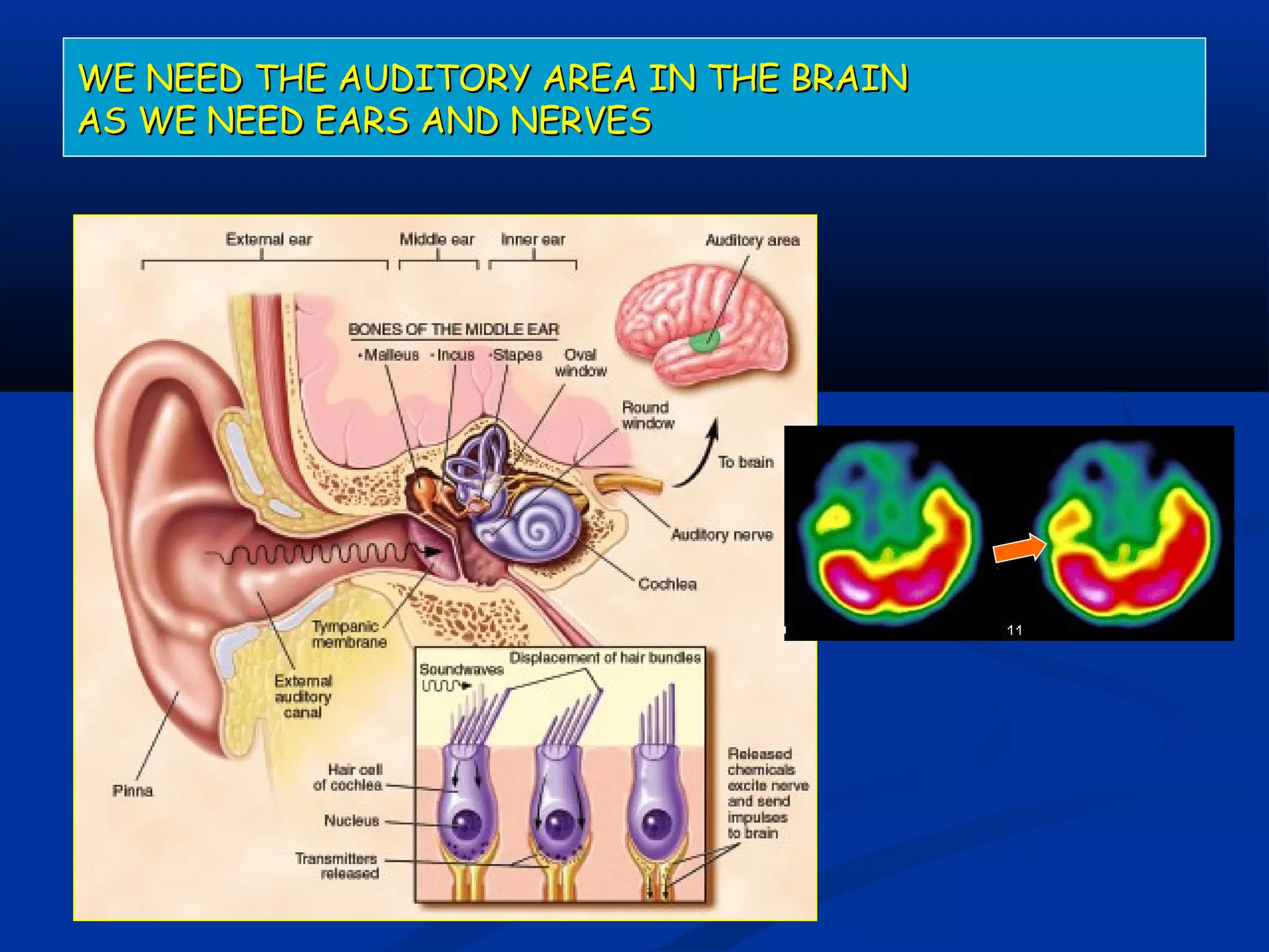 WE NEED THE AUDITORY AREA IN THE BRAINWE NEED THE AUDITORY AREA IN THE BRAIN
AS WE NEED EARS AND NERVESAS WE NEED EARS AND NERVES
 