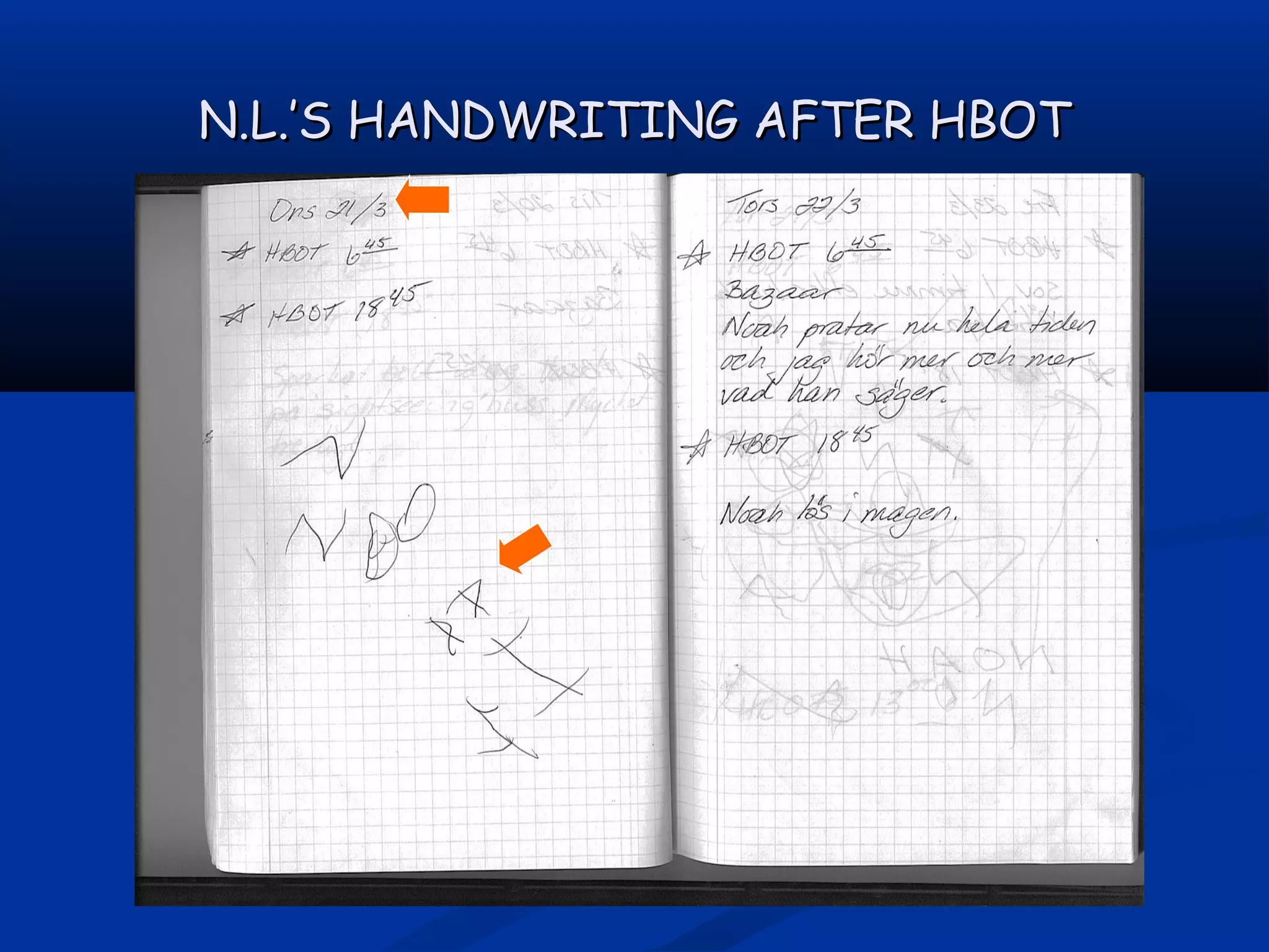 N.L.’S HANDWRITING AFTER HBOTN.L.’S HANDWRITING AFTER HBOT
 