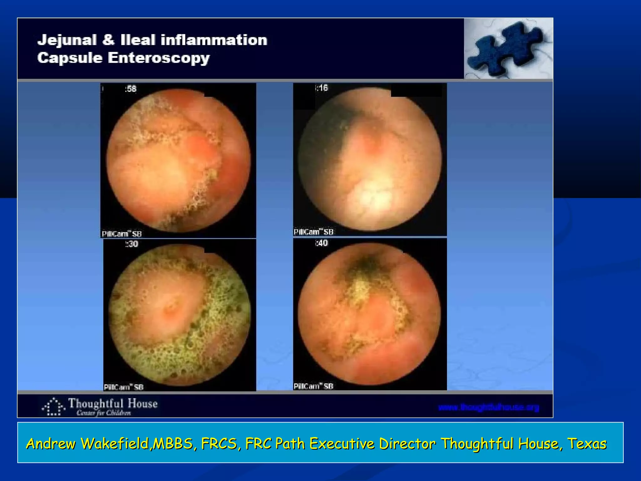 Andrew Wakefield,MBBS, FRCS, FRC Path Executive Director Thoughtful House, TexasAndrew Wakefield,MBBS, FRCS, FRC Path Executive Director Thoughtful House, Texas
 