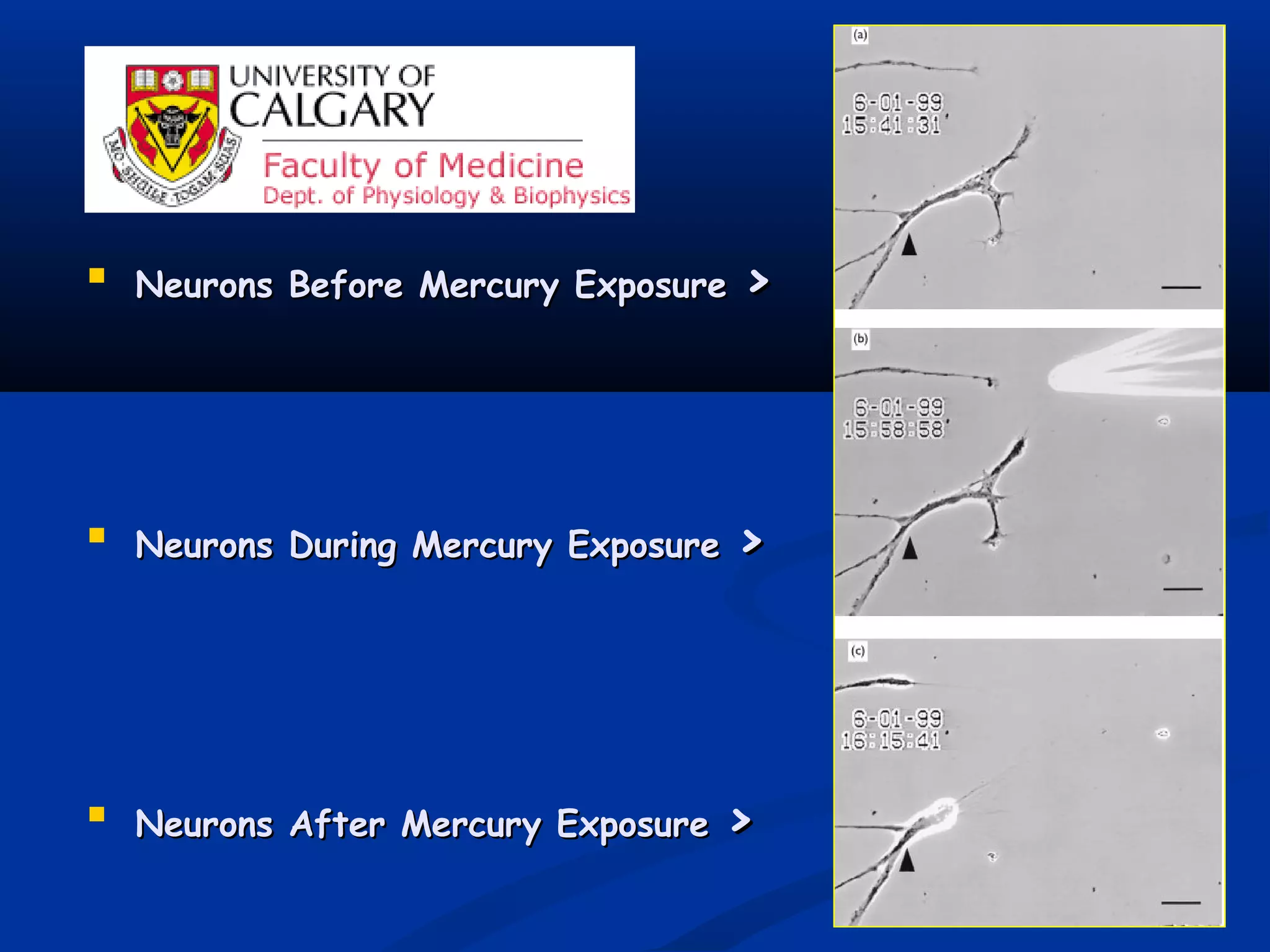 
Neurons Before Mercury ExposureNeurons Before Mercury Exposure >>

Neurons During Mercury ExposureNeurons During Mercury Exposure >>

Neurons After Mercury ExposureNeurons After Mercury Exposure >>
 