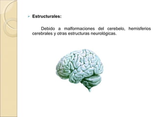 Estructurales:   Debido a malformaciones del cerebelo, hemisferios cerebrales y otras estructuras neurológicas. 