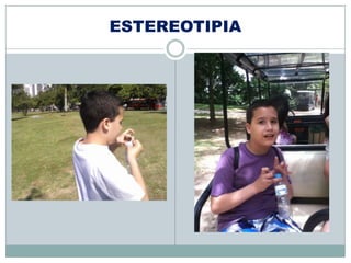 ESTEREOTIPIA
 
