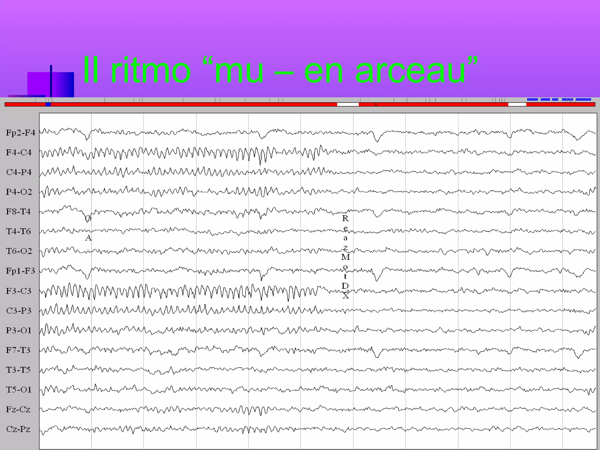 Il ritmo “mu – en arceau”

 