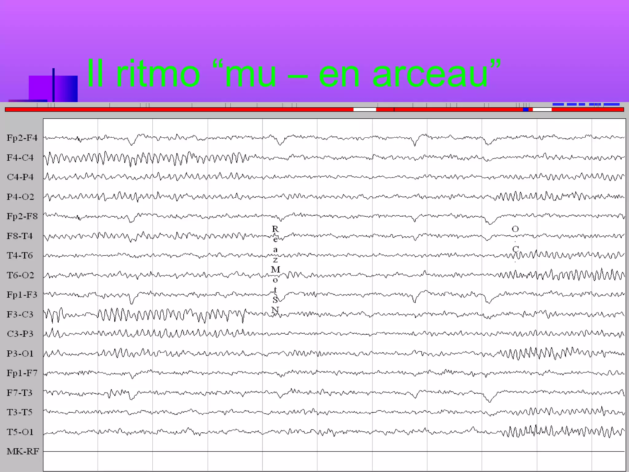 Il ritmo “mu – en arceau”

 
