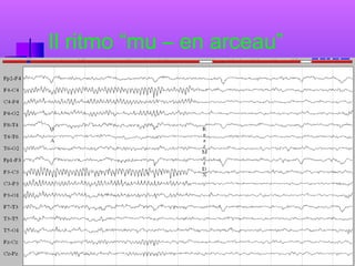 Il ritmo “mu – en arceau”

 