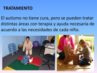 TRATAMIENTO

El autismo no tiene cura, pero se pueden tratar
distintas áreas con terapia y ayuda necesaria de
acuerdo a las necesidades de cada niño.
 
