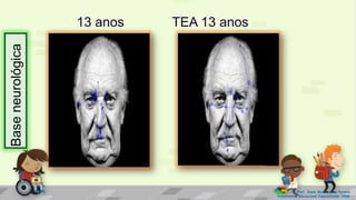 13 anos TEA 13 anos
Prof. Diane Marli Lemes Pereira
Atendimento Educacional Especializado /SRM
Baseneurológica
 