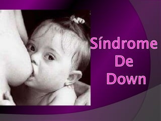 Síndrome  De  Down 