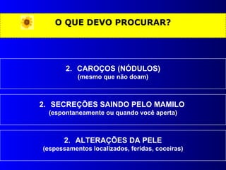 O QUE DEVO PROCURAR? CAROÇOS (NÓDULOS) (mesmo que não doam) SECREÇÕES SAINDO PELO MAMILO  (espontaneamente ou quando você aperta) ALTERAÇÕES DA PELE (espessamentos localizados, feridas, coceiras) 