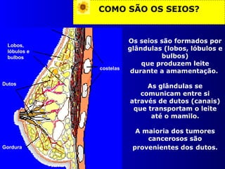 COMO SÃO OS SEIOS? Os seios são formados por glândulas (lobos, lóbulos e bulbos) que produzem leite durante a amamentação.  As glândulas se comunicam entre si através de dutos (canais) que transportam o leite até o mamilo. A maioria dos tumores cancerosos são provenientes dos   dutos. Lobos,  lóbulos e  bulbos Gordura costelas Dutos 