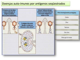 Doenças auto-imunes por antígenos seqüestrados
 