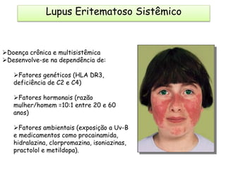 Lupus Eritematoso Sistêmico
Doença crônica e multisistêmica
Desenvolve-se na dependência de:
Fatores genéticos (HLA DR3,
deficiência de C2 e C4)
Fatores hormonais (razão
mulher/homem =10:1 entre 20 e 60
anos)
Fatores ambientais (exposição a Uv-B
e medicamentos como procainamida,
hidralazina, clorpromazina, isoniazinas,
practolol e metildopa).
 