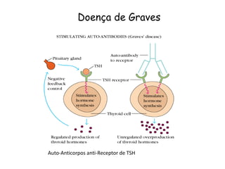 Doença de Graves Auto-Anticorpos anti-Receptor de TSH 
