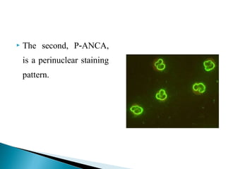 P Anca Pattern Autoantibodies detection methods | PPT