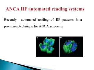 Autoantibodies detection methods | PPT