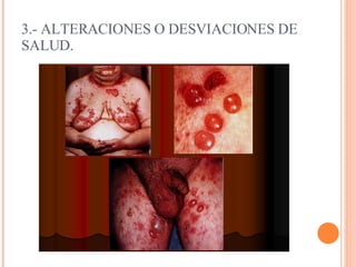 3.- ALTERACIONES O DESVIACIONES DE SALUD.