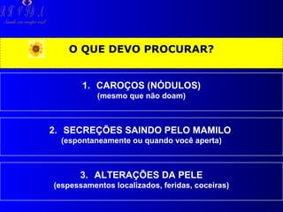 R H V ID A

Saúde em tempo real

O QUE DEVO PROCURAR?
1. CAROÇOS (NÓDULOS)
(mesmo que não doam)

2. SECREÇÕES SAINDO PELO MAMILO
(espontaneamente ou quando você aperta)

3. ALTERAÇÕES DA PELE
(espessamentos localizados, feridas, coceiras)

 
