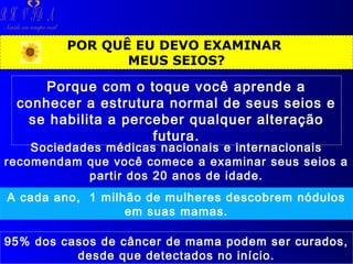 R H V ID A

Saúde em tempo real

POR QUÊ EU DEVO EXAMINAR
MEUS SEIOS?

Porque com o toque você aprende a
conhecer a estrutura normal de seus seios e
se habilita a perceber qualquer alteração
futura.

Sociedades médicas nacionais e internacionais
recomendam que você comece a examinar seus seios a
partir dos 20 anos de idade.
A cada ano, 1 milhão de mulheres descobrem nódulos
em suas mamas.
95% dos casos de câncer de mama podem ser curados,
desde que detectados no início.

 