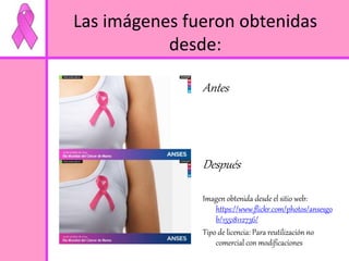Las imágenes fueron obtenidas 
desde: 
Antes 
Después 
Imagen obtenida desde el sitio web: 
https://www.flickr.com/photos/ansesgo 
b/15518112736/ 
Tipo de licencia: Para reutilización no 
comercial con modificaciones 
 