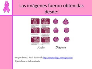Las imágenes fueron obtenidas 
desde: 
Antes Después 
Imagen obtenida desde el sitio web: http://maspsicologia.com/tag/cancer/ 
Tipo de licencia: Indeterminado 
 