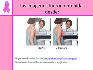 Las imágenes fueron obtenidas 
desde: 
Antes Después 
Imagen obtenida desde el sitio web: http://it.wikipedia.org/wiki/Mammografia 
Tipo de licencia: Para reutilización no comercial con modificaciones 
 