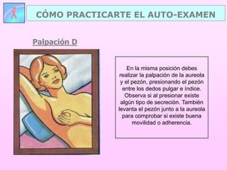 Palpación D
CÓMO PRACTICARTE EL AUTO-EXAMEN
En la misma posición debes
realizar la palpación de la aureola
y el pezón, presionando el pezón
entre los dedos pulgar e índice.
Observa si al presionar existe
algún tipo de secreción. También
levanta el pezón junto a la aureola
para comprobar si existe buena
movilidad o adherencia.
 