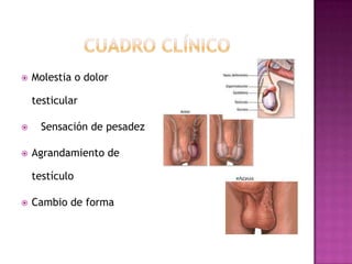 Cuadro clínicOMolestia o dolor testicularSensación de pesadez Agrandamiento de testículoCambio de forma