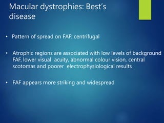 FUNDUS AUTOFLUORESCENCE | PPTX
