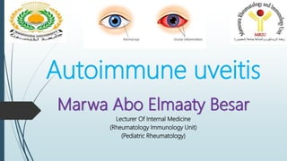 Autoimmune uveitis
Marwa Abo Elmaaty Besar
Lecturer Of Internal Medicine
(Rheumatology Immunology Unit)
(Pediatric Rheumatology)
 