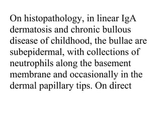 On histopathology, in linear IgA
dermatosis and chronic bullous
disease of childhood, the bullae are
subepidermal, with collections of
neutrophils along the basement
membrane and occasionally in the
dermal papillary tips. On direct
 