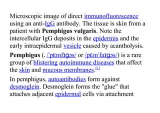 Microscopic image of direct immunofluorescence
using an anti-IgG antibody. The tissue is skin from a
patient with Pemphigus vulgaris. Note the
intercellular IgG deposits in the epidermis and the
early intraepidermal vesicle caused by acantholysis.
Pemphigus ( /ˈpɛmfɪɡəs/ or /pɛmˈfaɪɡəs/) is a rare
group of blistering autoimmune diseases that affect
the skin and mucous membranes.[1]
In pemphigus, autoantibodies form against
desmoglein. Desmoglein forms the "glue" that
attaches adjacent epidermal cells via attachment
 