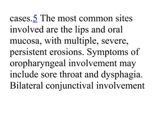 cases.5 The most common sites
involved are the lips and oral
mucosa, with multiple, severe,
persistent erosions. Symptoms of
oropharyngeal involvement may
include sore throat and dysphagia.
Bilateral conjunctival involvement
 